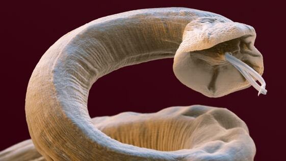 Parasiten in einer Person